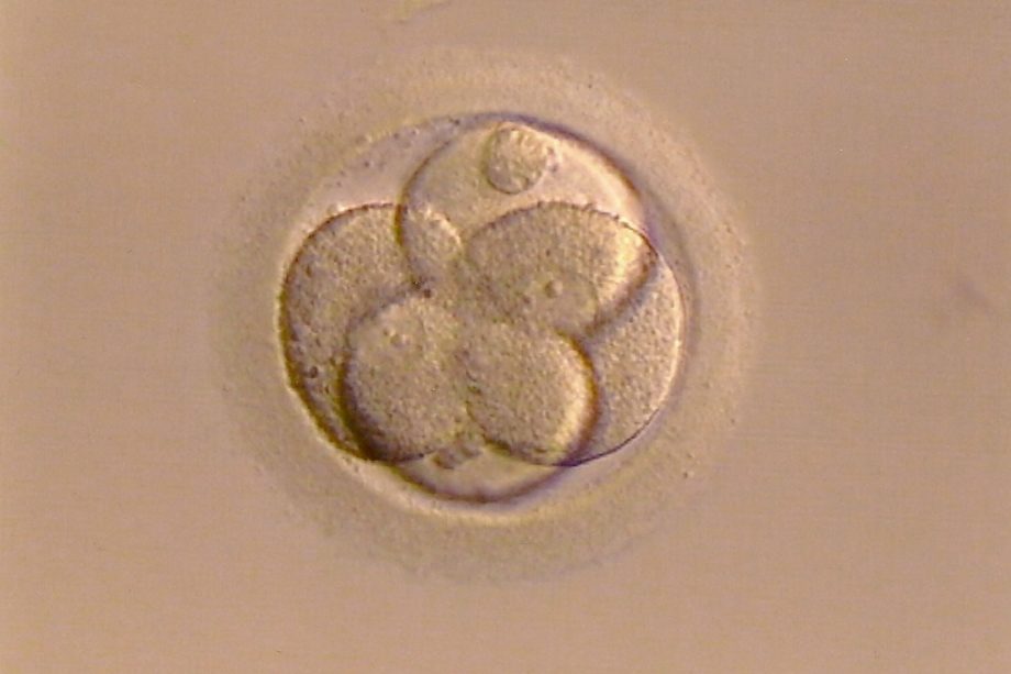 ovule fécondé en cours de multiplication - Image par Bellezza87 de https://pixabay.com/de/photos/befruchtete-eizelle-leben-entstehung-267976/