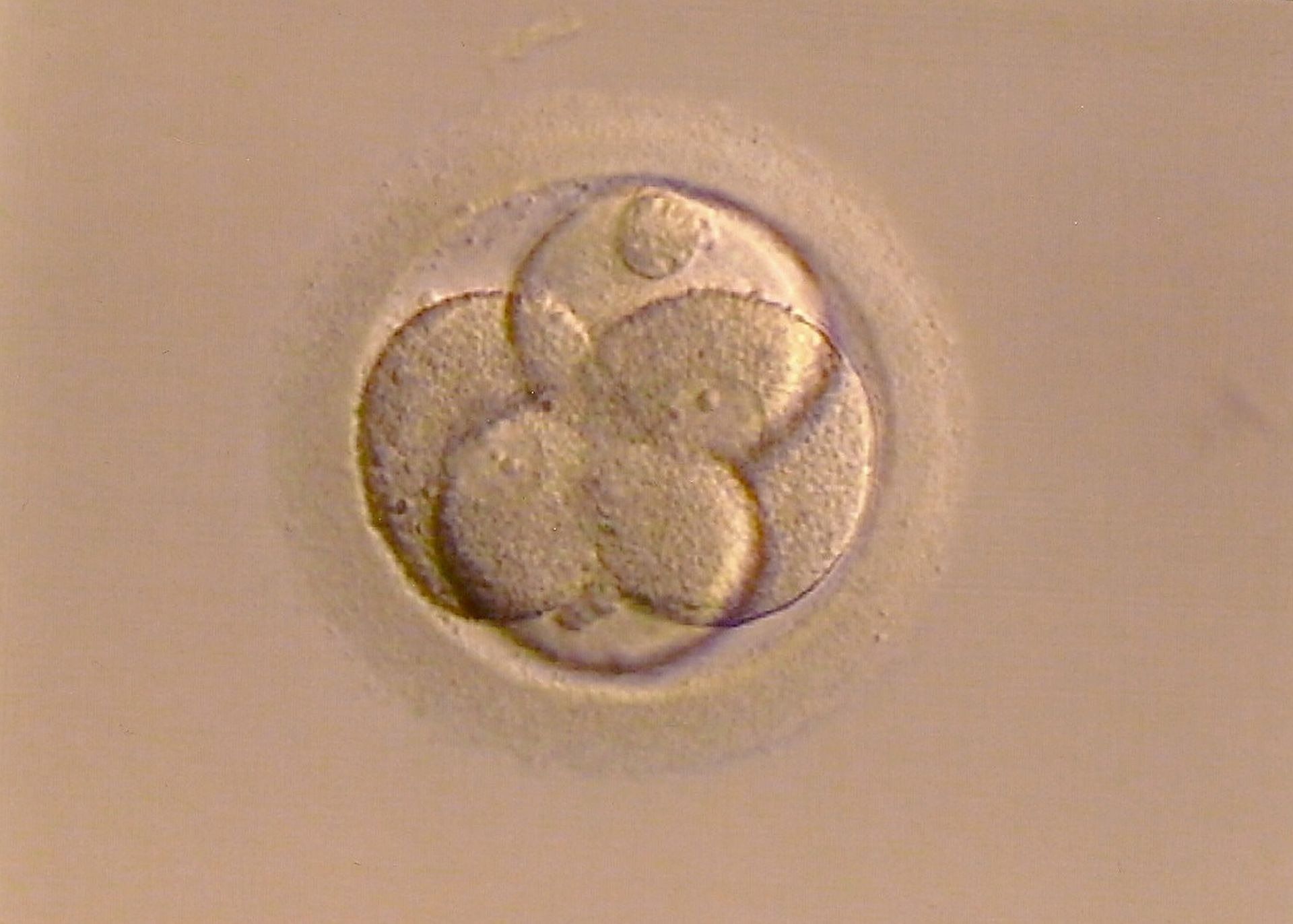 ovule fécondé en cours de multiplication - Image par Bellezza87 de https://pixabay.com/de/photos/befruchtete-eizelle-leben-entstehung-267976/
