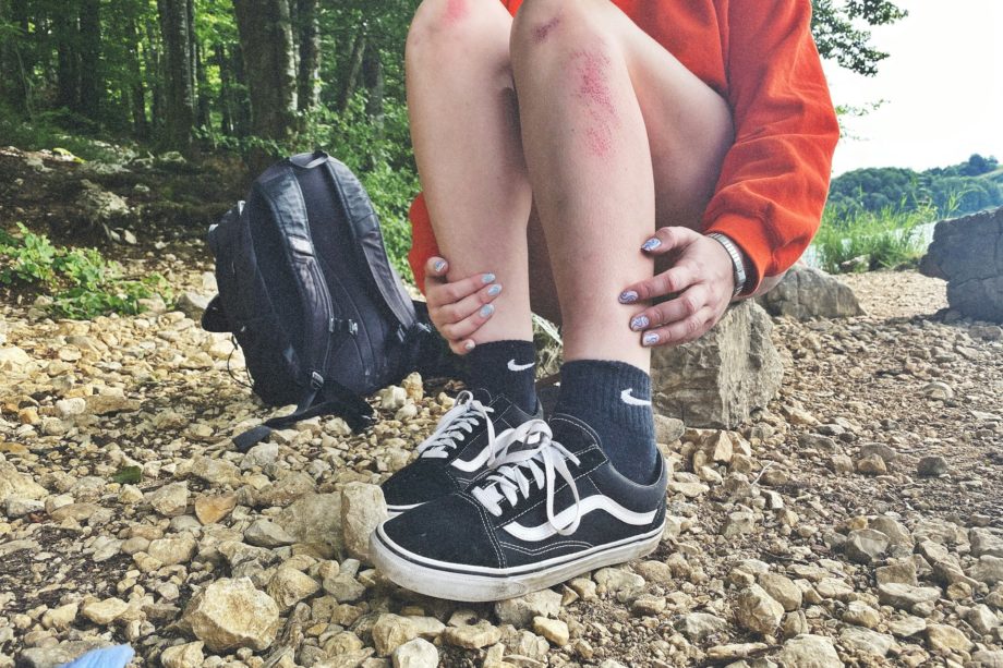 Jeune assis dans un terrai caillouteux, les jambes égratignées, grattées - Photo de Coline Haslé sur https://unsplash.com/fr/photos/personne-en-chaussures-de-sport-nike-noires-et-blanches-assise-sur-un-sol-rocheux-OvXUMmh_Zlk