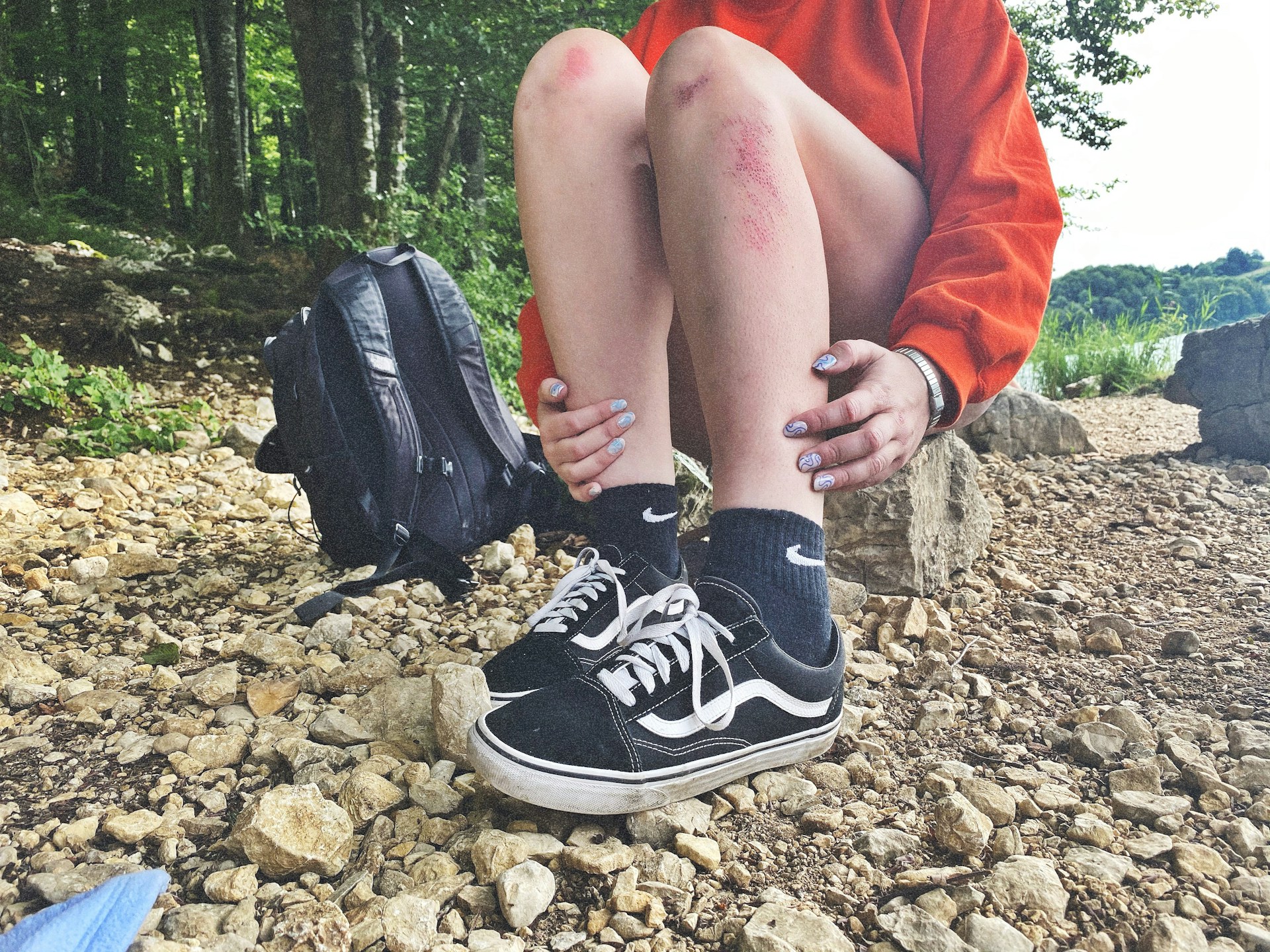Jeune assis dans un terrai caillouteux, les jambes égratignées, grattées - Photo de Coline Haslé sur https://unsplash.com/fr/photos/personne-en-chaussures-de-sport-nike-noires-et-blanches-assise-sur-un-sol-rocheux-OvXUMmh_Zlk